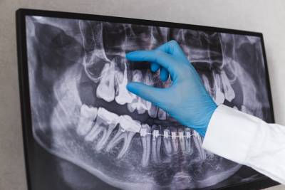 oral diagnoz oral diagnoz